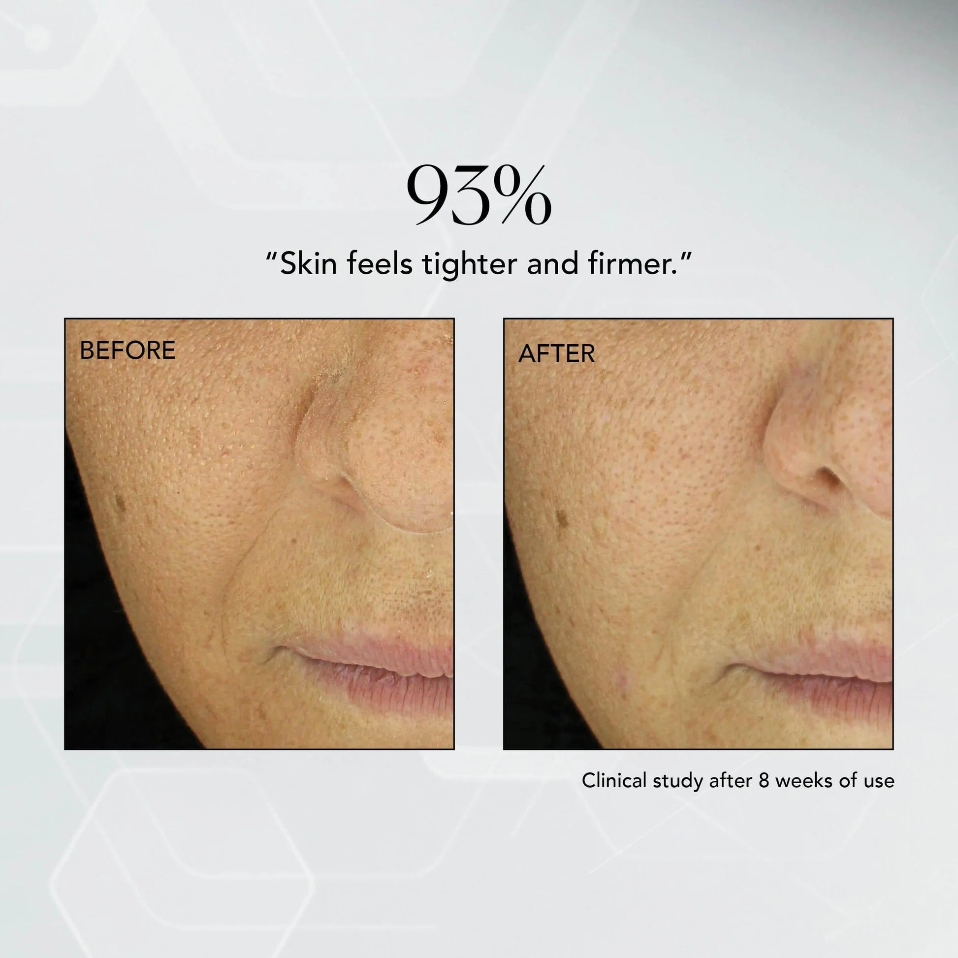 MD Advanced Hydration Crème - Image 5